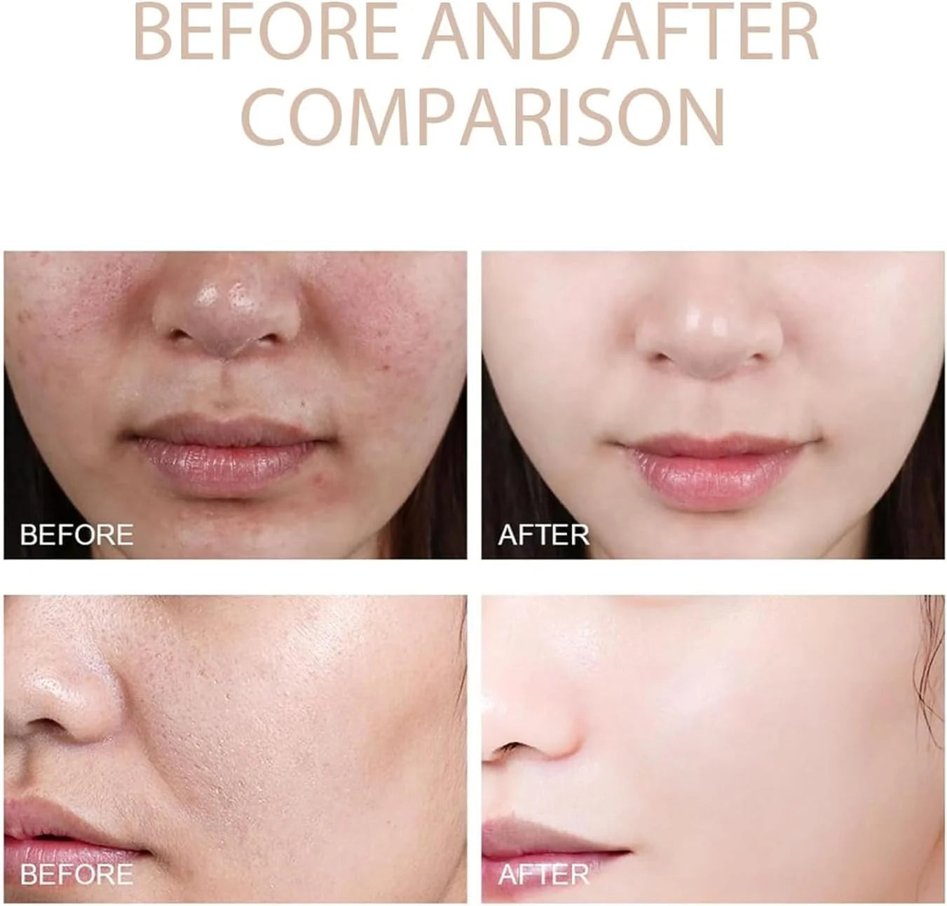 PHANSTA™ Purifying Peeling Gel