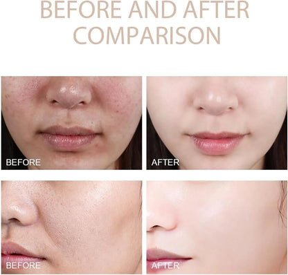 PHANSTA™ Purifying Peeling Gel