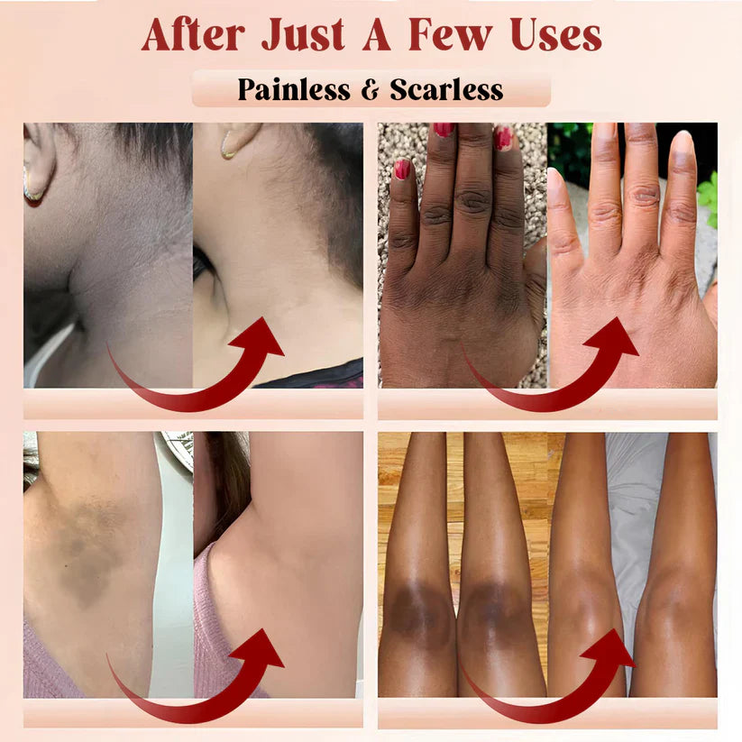PHANSTA™ Purifying Peeling Gel
